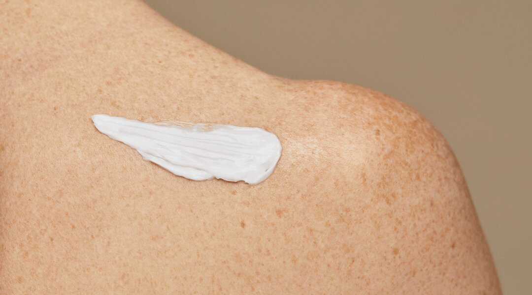 Blog-Relieve_skin_discomfort_with_nourist_s_Scratch-Free_Face_and_Body_Cream