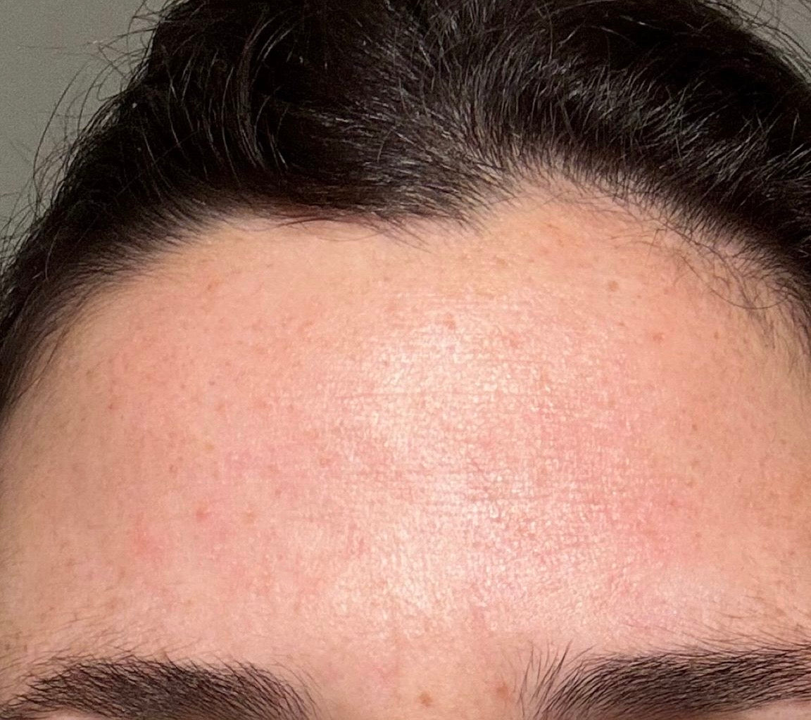 Voor&Na-Klant-Moisturizer-Na