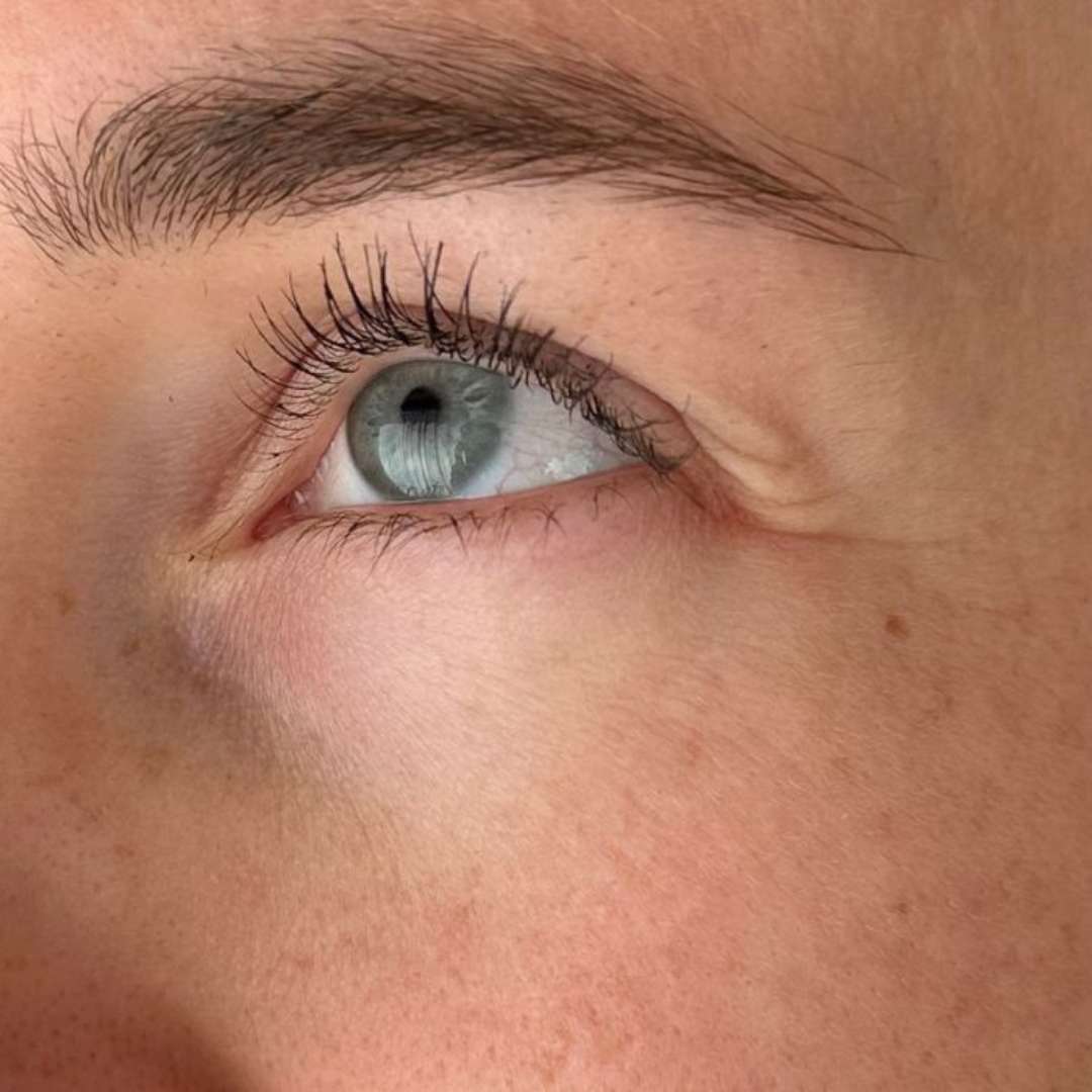 Voor_Na-Sil-Eye_Lip_Cream-na-Productpage