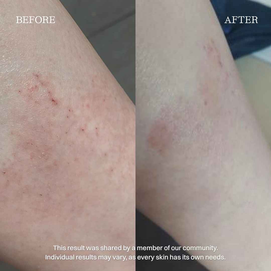nourist-voor_en_na-body_and_face_cream-2