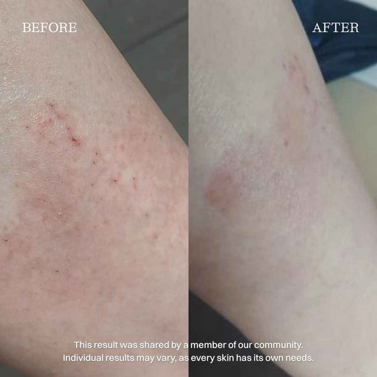 nourist-voor_en_na-body_and_face_cream-2
