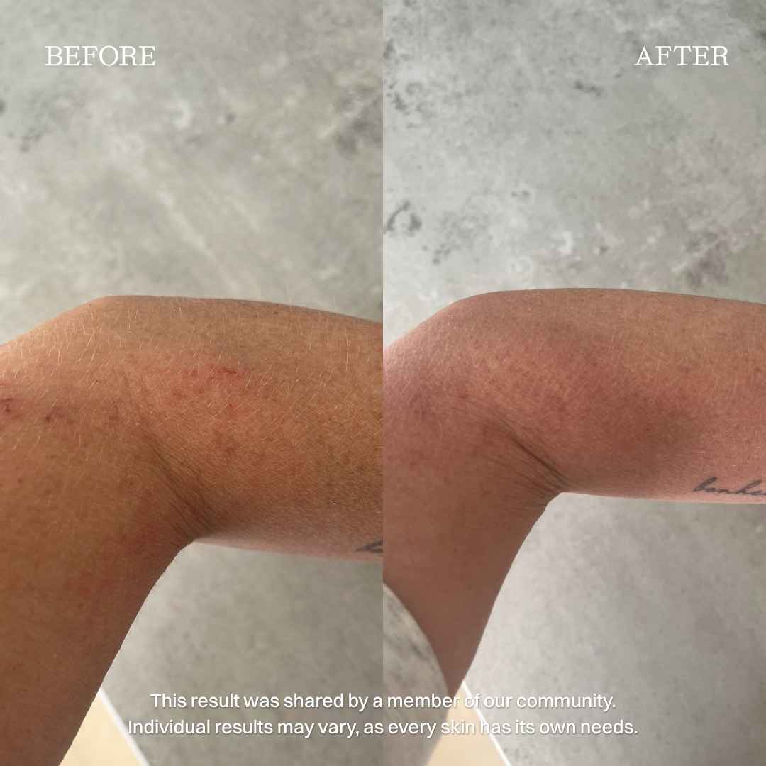 nourist-voor_en_na-body_and_face_cream-3