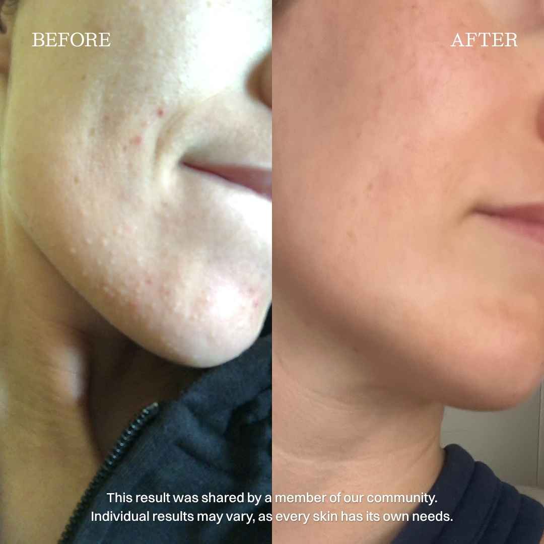 nourist-voor_en_na-brighten_up_serum-1