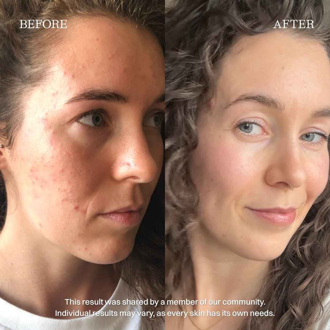 nourist-voor_en_na-cleanser