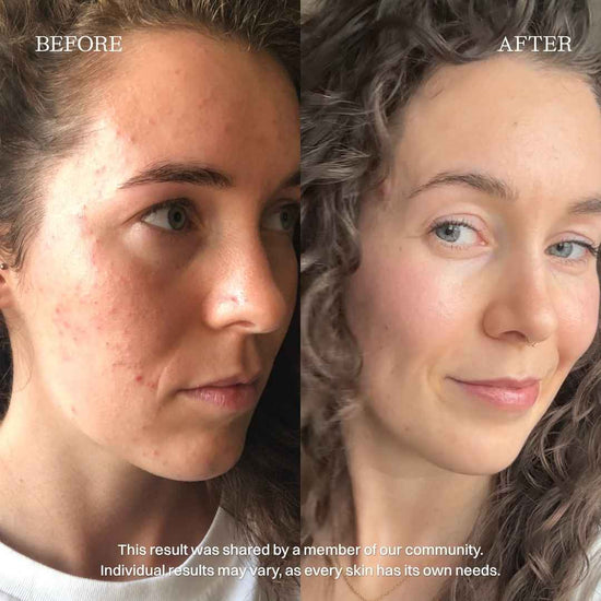 nourist-voor_en_na-cleanser