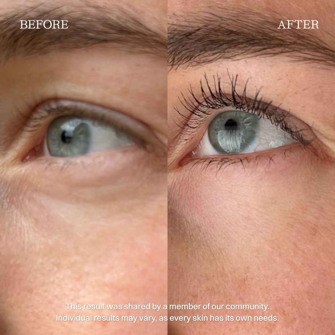 nourist-voor_en_na-eye_and_lip_cream-1
