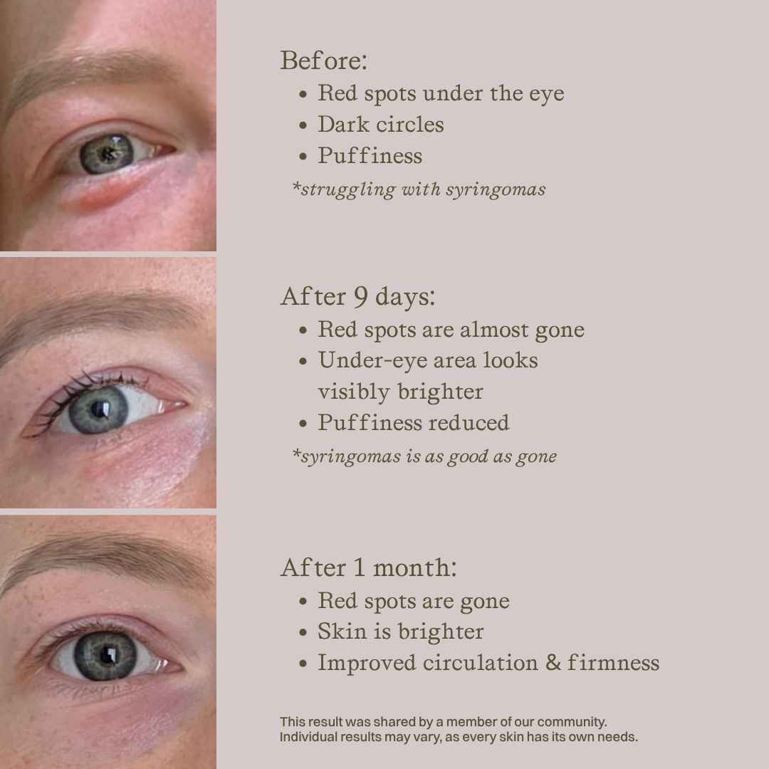 nourist-voor_en_na-eye_and_lip_cream-3