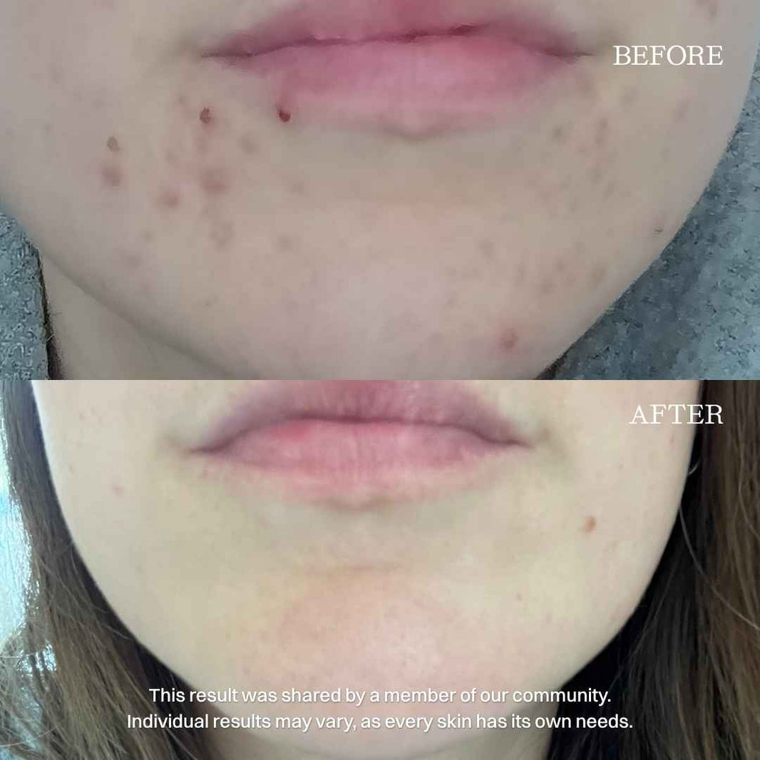 nourist-voor_en_na-micellar_water