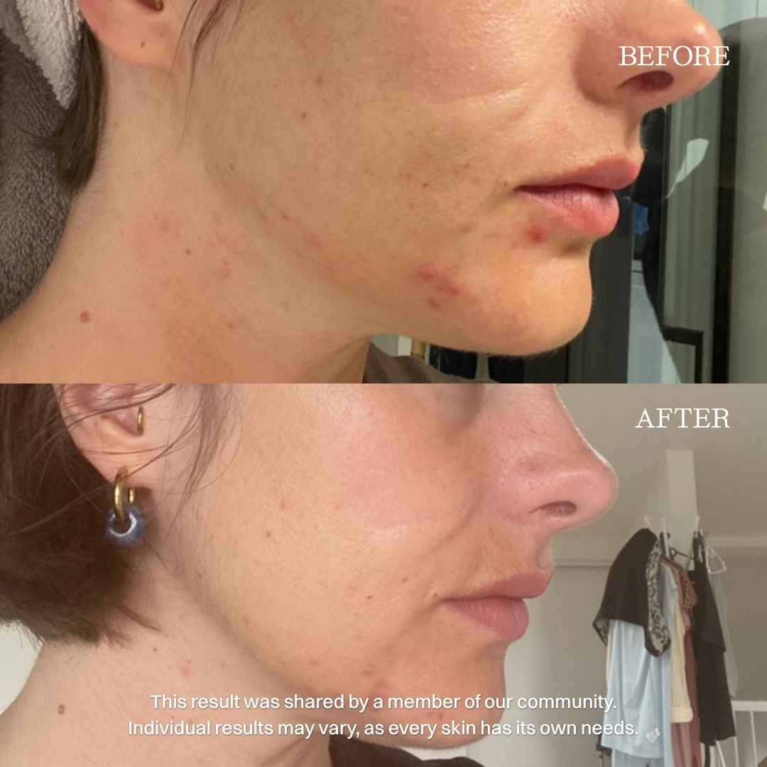 nourist-voor_en_na-sunscreen-1